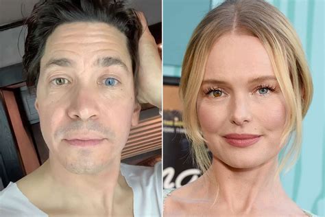 Heres Why Kate Bosworth Has Two Different Colored Eyes